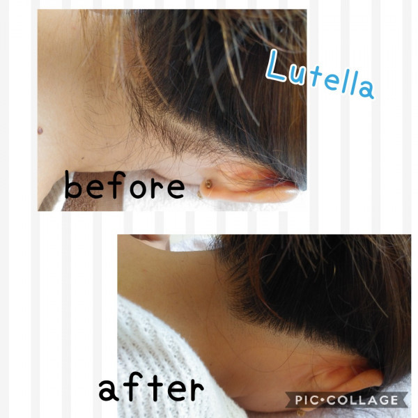 Lutella～ルテラ～ | Before→After