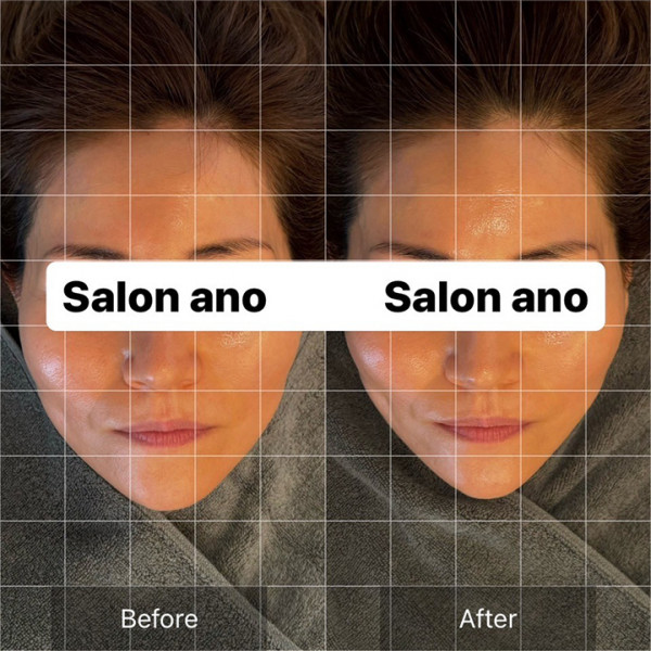 Salon ano | 脳洗浄®︎フルコース