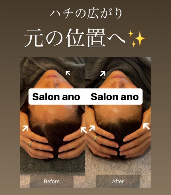 Salon ano | 