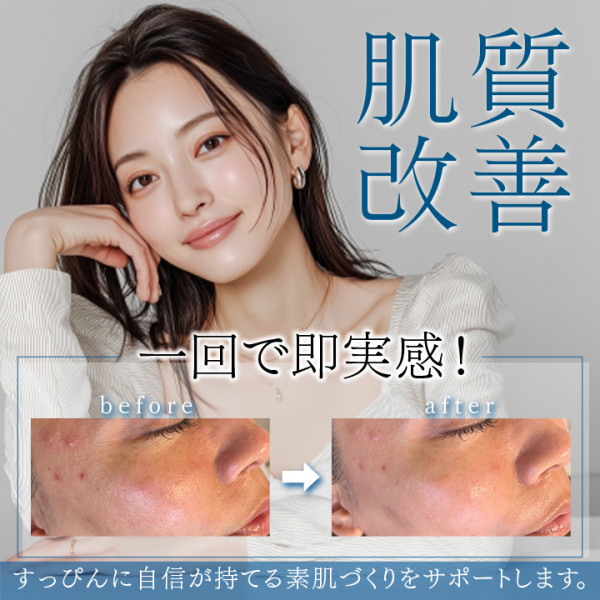 【シミ改善・ハーブピーリング・最新光美容機器】Bel Eclatの写真(沖縄県那覇市)